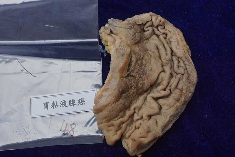 人体病理标本