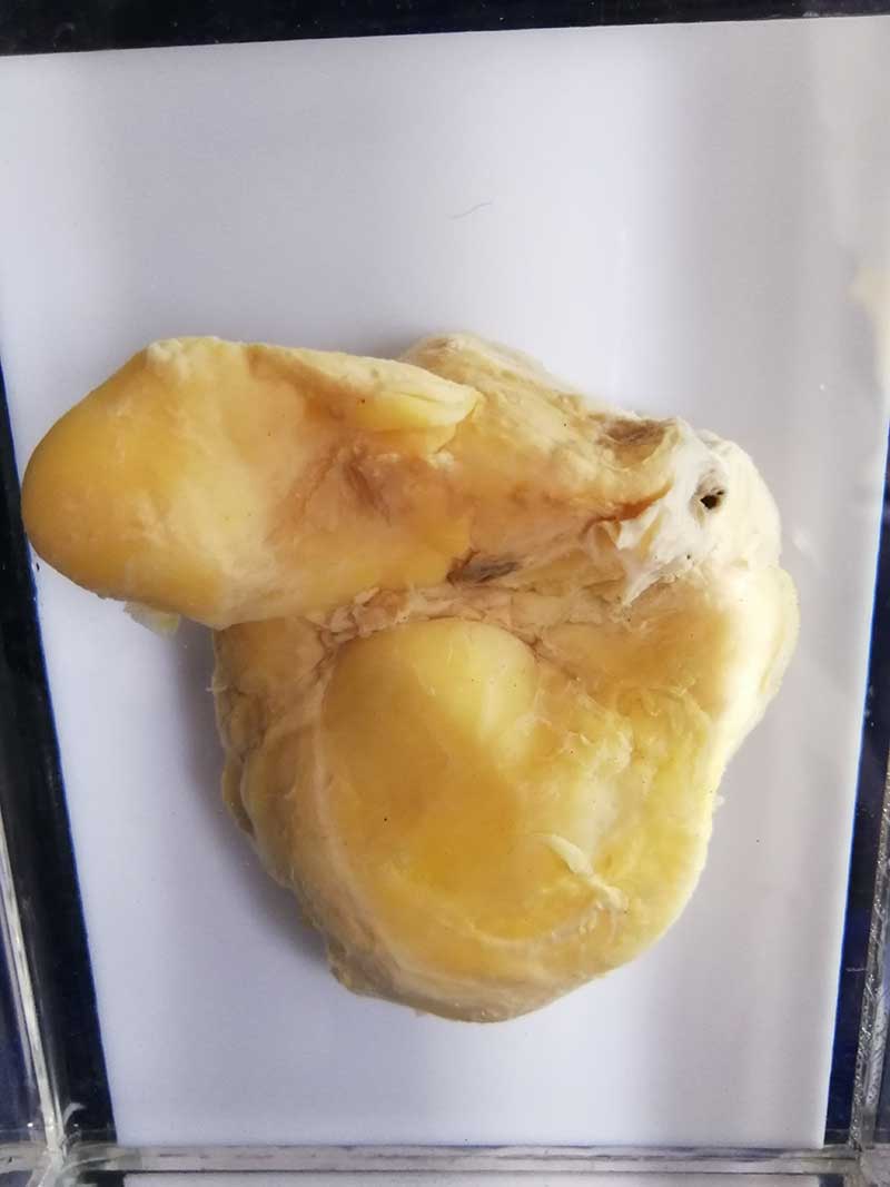 人体病理标本