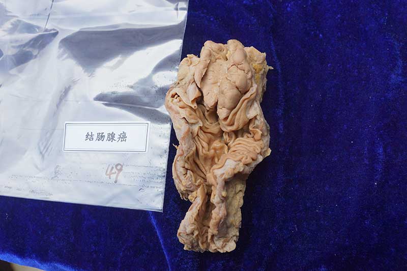 人体病理标本