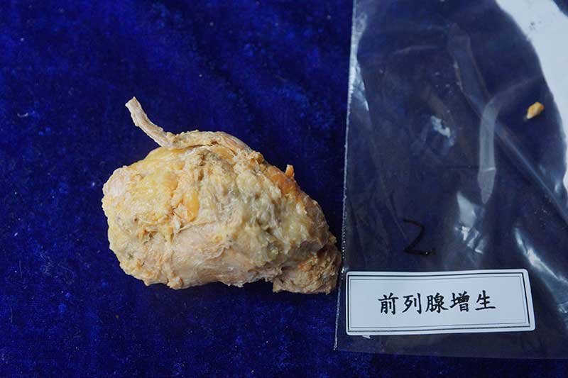人体病理标本