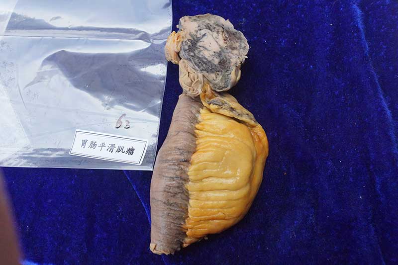 人体病理标本